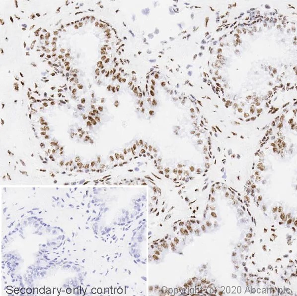 Immunohistochemistry (Formalin/PFA-fixed paraffin-embedded sections) - Anti-TDP43 antibody [EPR5810] - BSA and Azide free (AB185133), expandable thumbnail