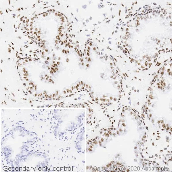 Immunohistochemistry (Formalin/PFA-fixed paraffin-embedded sections) - Anti-TDP43 antibody [EPR5810] - BSA and Azide free (AB185133)