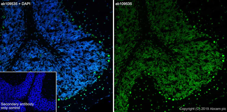 Immunohistochemistry (Frozen sections) - Anti-TDP43 antibody [EPR5810] - BSA and Azide free (AB185133)