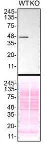 Western blot - Anti-TDP43 antibody [EPR5810] - BSA and Azide free (AB185133)