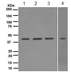 Western blot - Anti-TDP43 antibody [EPR5810] - BSA and Azide free (AB185133), expandable thumbnail