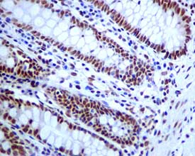 Immunohistochemistry (Formalin/PFA-fixed paraffin-embedded sections) - Anti-TDP43 antibody [EPR5811] (AB133547)