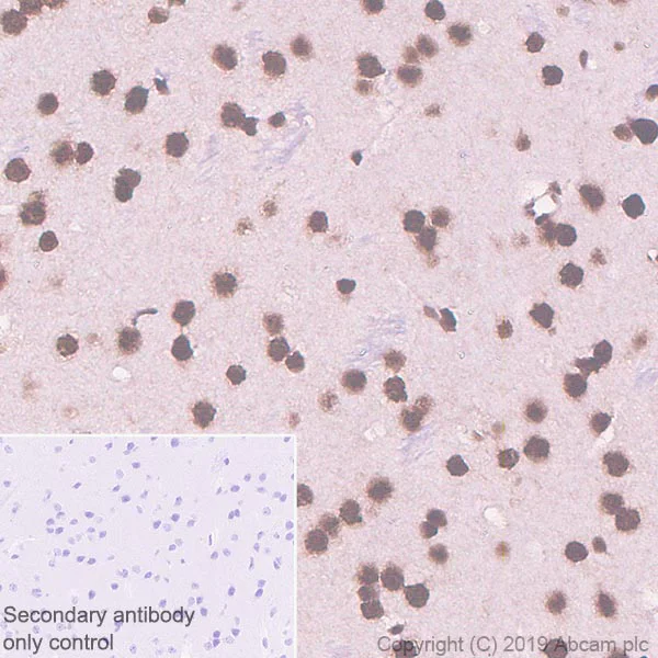 Immunohistochemistry (Formalin/PFA-fixed paraffin-embedded sections) - Anti-TDP43 antibody [EPR5811] (AB133547)