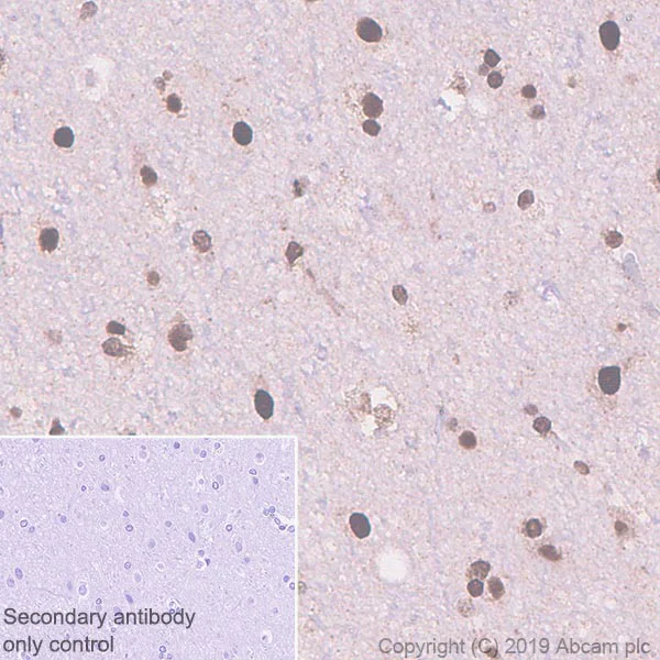 Immunohistochemistry (Formalin/PFA-fixed paraffin-embedded sections) - Anti-TDP43 antibody [EPR5811] (AB133547)