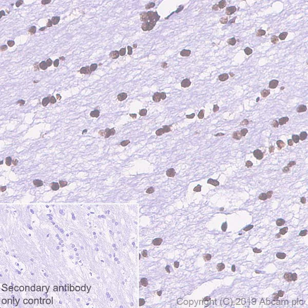 Immunohistochemistry (Formalin/PFA-fixed paraffin-embedded sections) - Anti-TDP43 antibody [EPR5811] (AB133547)