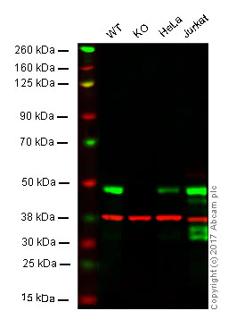 Western blot - Anti-TDP43 antibody [EPR5811] (AB133547)