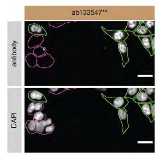 Immunocytochemistry/ Immunofluorescence - Anti-TDP43 antibody [EPR5811] - BSA and Azide free (ab248546), expandable thumbnail