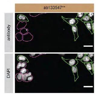 Immunocytochemistry/ Immunofluorescence - Anti-TDP43 antibody [EPR5811] - BSA and Azide free (AB248546)