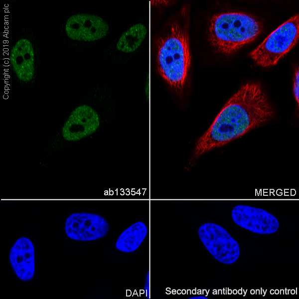 Immunocytochemistry/ Immunofluorescence - Anti-TDP43 antibody [EPR5811] - BSA and Azide free (AB248546), expandable thumbnail