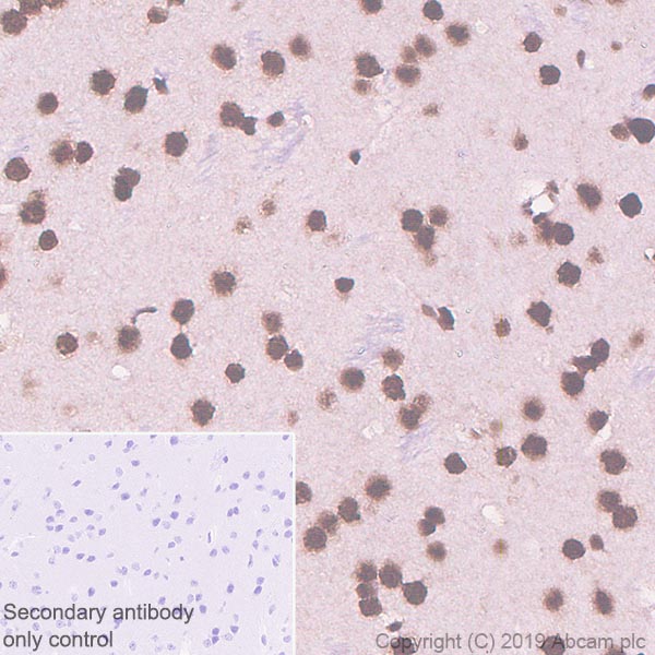 Immunohistochemistry (Formalin/PFA-fixed paraffin-embedded sections) - Anti-TDP43 antibody [EPR5811] - BSA and Azide free (AB248546), expandable thumbnail