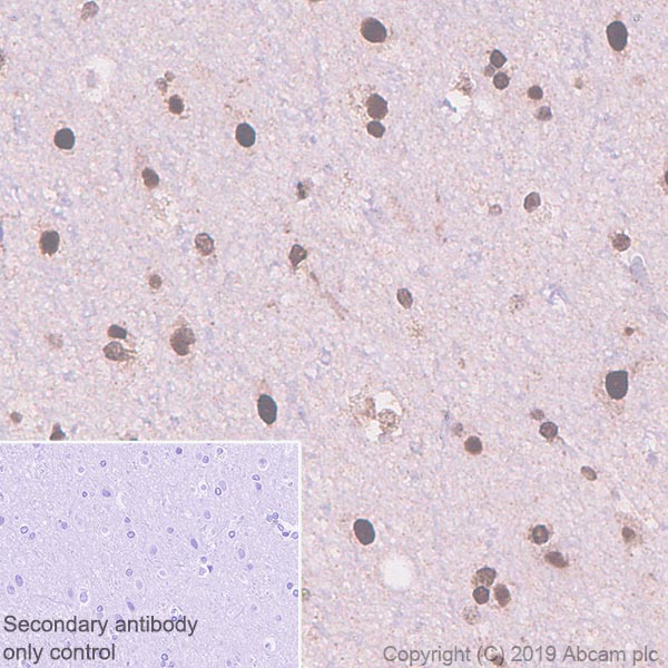 Immunohistochemistry (Formalin/PFA-fixed paraffin-embedded sections) - Anti-TDP43 antibody [EPR5811] - BSA and Azide free (AB248546), expandable thumbnail