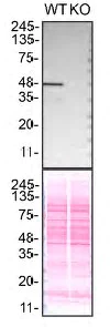 Western blot - Anti-TDP43 antibody [EPR5811] - BSA and Azide free (AB248546)