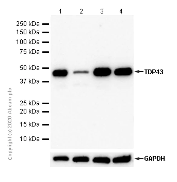 Western blot - Anti-TDP43 antibody [EPR5811] - BSA and Azide free (AB248546)