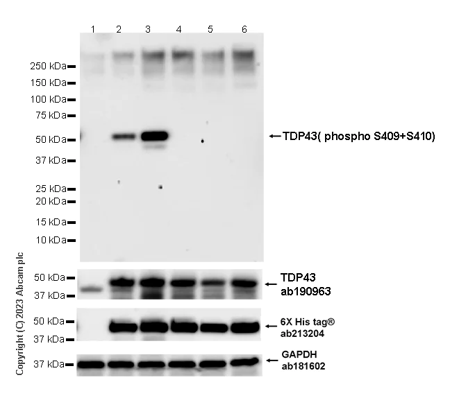 Western blot - Anti-TDP43 (phospho S409 + pS410) antibody [EPR24512-120] - BSA and Azide free (AB314300)
