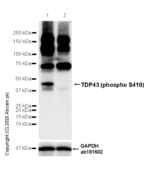 Western blot - Anti-TDP43 (phospho S410) antibody [EPR24512-8] (AB314301)