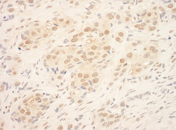 Immunohistochemistry (Formalin/PFA-fixed paraffin-embedded sections) - Anti-TDRD3 antibody (AB95879), expandable thumbnail