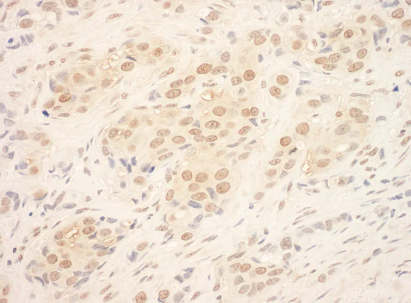 Immunohistochemistry (Formalin/PFA-fixed paraffin-embedded sections) - Anti-TDRD3 antibody (AB95879)