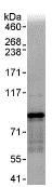 Immunoprecipitation - Anti-TDRD3 antibody (AB95879), expandable thumbnail