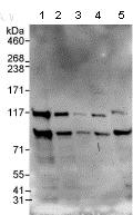Western blot - Anti-TDRD3 antibody (AB95879), expandable thumbnail