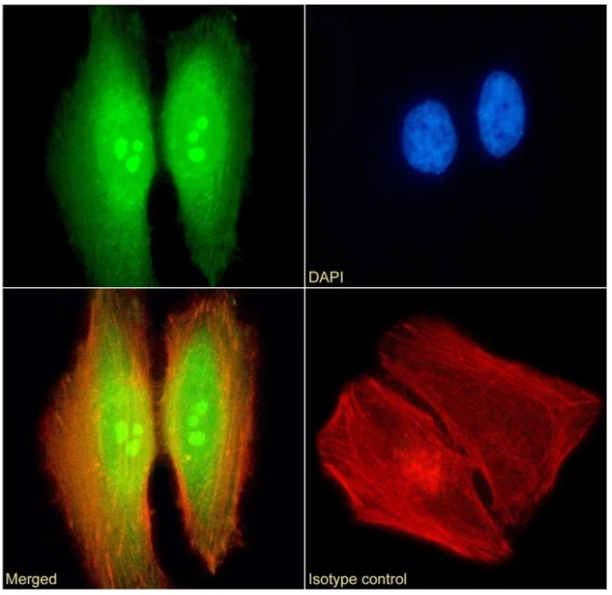 Immunocytochemistry/ Immunofluorescence - Anti-TDRD3 antibody [RAB-C419] (AB317727)