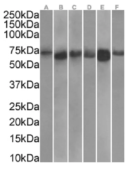 Western blot - Anti-TDRD3 antibody [RAB-C419] (AB317727)