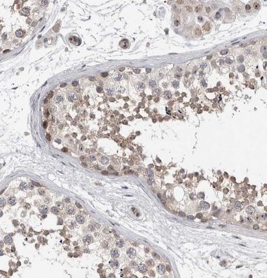 Immunohistochemistry (Formalin/PFA-fixed paraffin-embedded sections) - Anti-TDRD7 antibody (AB224462)
