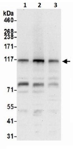 Western blot - Anti-TDRD7 antibody (AB241349), expandable thumbnail