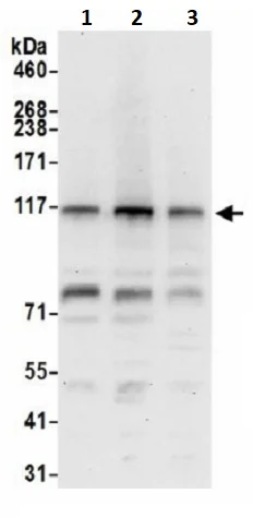 Western blot - Anti-TDRD7 antibody (AB241349)