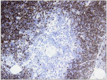 Immunohistochemistry (Formalin/PFA-fixed paraffin-embedded sections) - Anti-TdT antibody [41A] (AB68886)