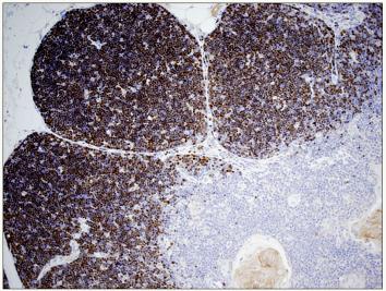 Immunohistochemistry (Formalin/PFA-fixed paraffin-embedded sections) - Anti-TdT antibody [41A] (AB68886)