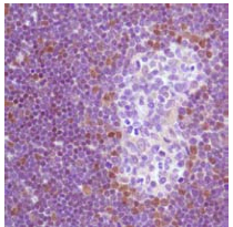 Immunohistochemistry (Formalin/PFA-fixed paraffin-embedded sections) - Anti-TdT antibody (AB125152)