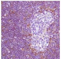 Immunohistochemistry (Formalin/PFA-fixed paraffin-embedded sections) - Anti-TdT antibody (AB125152)