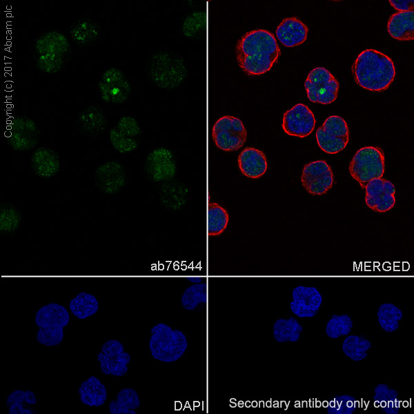 Immunocytochemistry/ Immunofluorescence - Anti-TdT antibody [EPR2976Y] (AB76544), expandable thumbnail