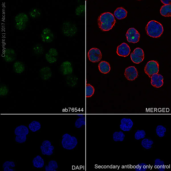 Immunocytochemistry/ Immunofluorescence - Anti-TdT antibody [EPR2976Y] (AB76544)