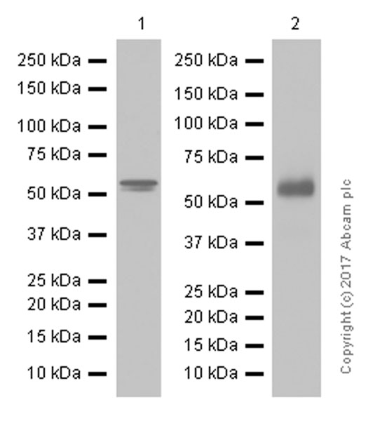 Western blot - Anti-TdT antibody [EPR2976Y] (AB76544), expandable thumbnail