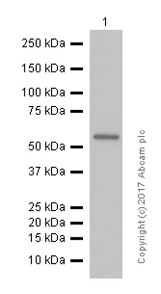 Western blot - Anti-TdT antibody [EPR2976Y] (AB76544), expandable thumbnail