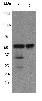 Western blot - Anti-TdT antibody [EPR2976Y] (ab76544), expandable thumbnail