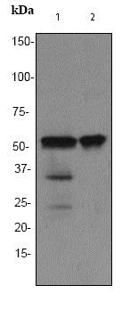 Western blot - Anti-TdT antibody [EPR2976Y] (AB76544)
