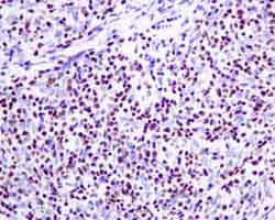 Immunohistochemistry (Formalin/PFA-fixed paraffin-embedded sections) - Anti-TdT antibody [EPR9732] (AB155082)
