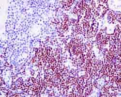Immunohistochemistry (Formalin/PFA-fixed paraffin-embedded sections) - Anti-TdT antibody [EPR9732] (AB155082)