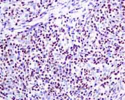 Immunohistochemistry (Formalin/PFA-fixed paraffin-embedded sections) - Anti-TdT antibody [EPR9732] - BSA and Azide free (AB249177)
