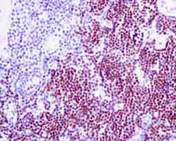 Immunohistochemistry (Formalin/PFA-fixed paraffin-embedded sections) - Anti-TdT antibody [EPR9732] - BSA and Azide free (AB249177)