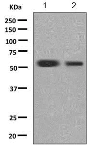 Western blot - Anti-TdT antibody [EPR9732] - BSA and Azide free (AB249177)