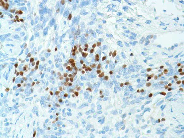Immunohistochemistry (Formalin/PFA-fixed paraffin-embedded sections) - Anti-TdT antibody [SP150] (AB183341)