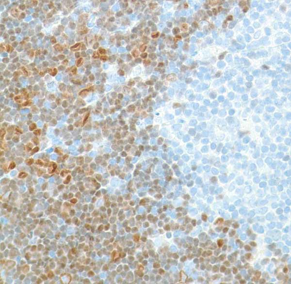Immunohistochemistry (Formalin/PFA-fixed paraffin-embedded sections) - Anti-TdT antibody [SP150] (AB183341)