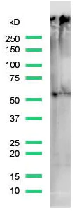Western blot - Anti-TdT antibody [SP150] (AB183341)