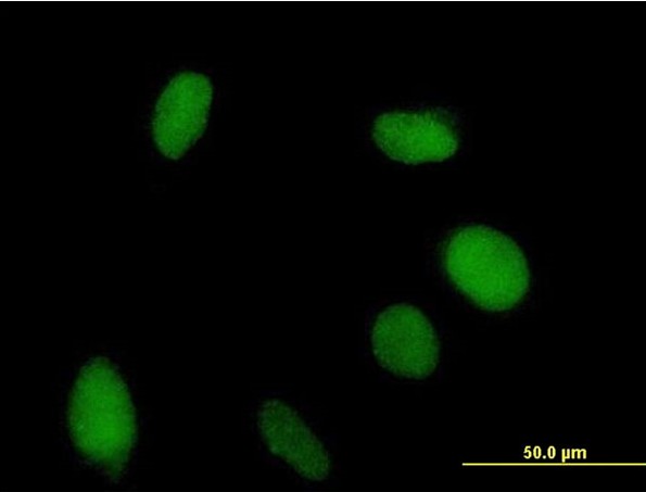 Immunocytochemistry/ Immunofluorescence - Anti-TDU antibody (AB169163)