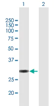 Western blot - Anti-TDU antibody (AB169163)