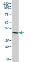 Western blot - Anti-TDU antibody (AB169163)