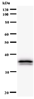 Western blot - Anti-TEA domain family member 2/ETF antibody [404C5a] (AB54374), expandable thumbnail